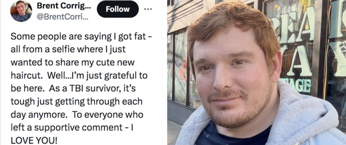 Revenu de loin - il a failli mourir - la super porn star Brent Corrigan vient de poster un selfie qui suscite nombre de commentaires enthousiastes mais aussi quelques-uns qui sont blessants