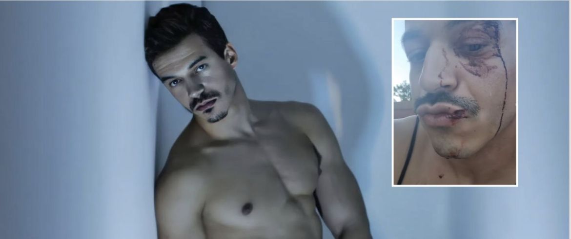 Il y a un an, Jonathan Miranda a été victime d'une agression homophobe par un prétendu "policier"